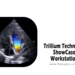 دانلود نرم افزار Trillium Technology ShowCase Workstation 6.6.2.1 برنامه مدیریت تصاویر پزشکی به صورت سریع و اثربخش